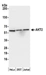 Detection of human AKT2 by western blot.