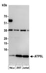 Detection of human ATP5L by western blot.