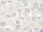 Detection of human NUP50 by immunohistochemistry.