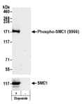 Detection of Phospho SMC1 (S966) by western blot.