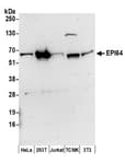 Detection of human and mouse EPI64 by western blot.