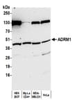 Detection of human ADRM1 by western blot.