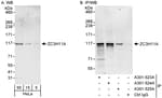 Detection of human ZC3H11A by western blot and immunoprecipitation.