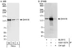 Detection of human DHX16 by western blot and immunoprecipitation.