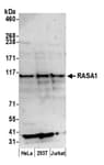 Detection of human RASA1 by western blot.