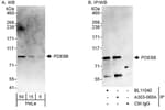 Detection of human PDE8B by western blot and immunoprecipitation.