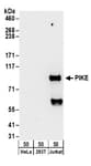 Detection of human PIKE by western blot.