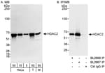 Detection of human and mouse HDAC2 by western blot (h&amp;m) and immunoprecipitation (h).