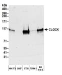 Detection of mouse CLOCK by western blot.