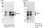 Detection of human RBEL1 by western blot and immunoprecipitation.