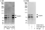 Detection of human FOXP1 by western blot and immunoprecipitation.