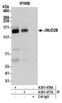 Detection of human JMJD2B by western blot of immunoprecipitates.