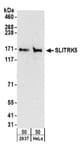 Detection of human SLITRK5 by western blot.