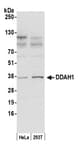 Detection of human DDAH1 by western blot.