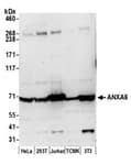 Detection of human and mouse ANXA6 by western blot.
