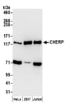 Detection of human CHERP by western blot.