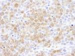Detection of mouse NUDC by immunohistochemistry.