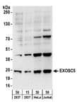 Detection of human EXOSC5 by western blot.