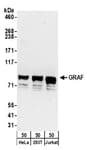 Detection of human GRAF by western blot.