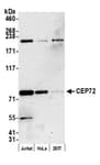 Detection of human CEP72 by western blot.