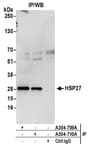 Detection of human HSP27 by western blot of immunoprecipitates.