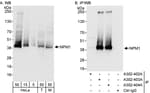 Detection of human and mouse NPM1 by western blot (h &amp; m) and immunoprecipitation (h).