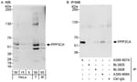 Detection of human and mouse PPP3CA by western blot (h&amp;m) and immunoprecipitation (h).