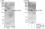 Detection of human CYFIP1 by western blot and immunoprecipitation.