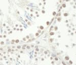 Detection of mouse Chk1 by immunohistochemistry.
