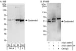 Detection of human Dysbindin1 by western blot and immunoprecipitation.