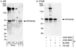 Detection of human PPP2R3B by western blot and immunoprecipitation.