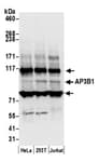 Detection of human AP3B1 by western blot.