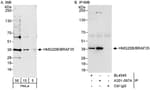 Detection of human HMG20B/BRAF35 by western blot and immunoprecipitation.