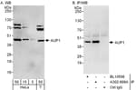 Detection of human AUP1 by western blot and immunoprecipitation.