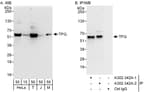 Detection of human and mouse TFG by western blot (h&amp;m) and immunoprecipitation (h).
