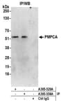 Detection of human PMPCA by western blot of immunoprecipitates.