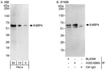 Detection of human E4BP4 by western blot and immunoprecipitation.