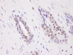 Detection of human CARM1 by immunohistochemistry.