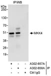 Detection of human MKK4 by western blot of immunoprecipitates.