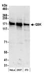 Detection of human and mouse QSK by western blot.
