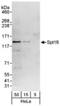 Detection of human Spt16 by western blot.