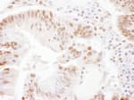 Detection of human SSRP1 by immunohistochemistry.