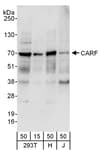 Detection of human CARF by western blot.