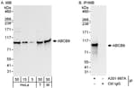 Detection of human and mouse ABCB9 by western blot (h&amp;m) and immunoprecipitation (h).