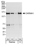 Detection of human CARMA1 by western blot.