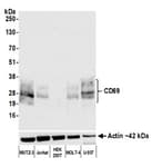 Detection of human CD69 by western blot.