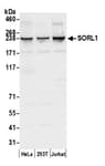 Detection of human SORL1 by western blot.