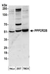 Detection of human and mouse PPP2R2B by western blot.