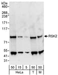 Detection of human and mouse RSK2 by western blot.