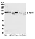 Detection of human RENT1 by western blot.